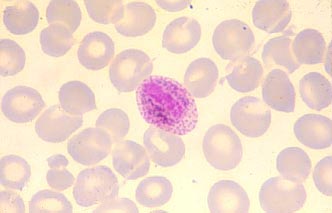 vivax_male_gametocyte.jpg (10415 ֹ(ji))